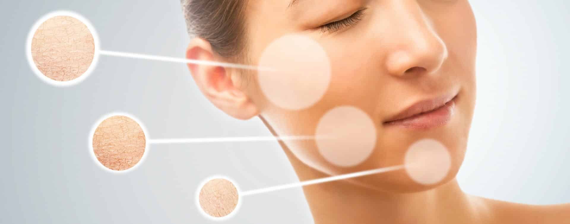pelle secca viso