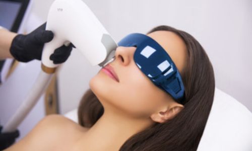 estetista con guanti in lattice neri effettua luce pulsata sul viso di una paziente con occhiali di protezione